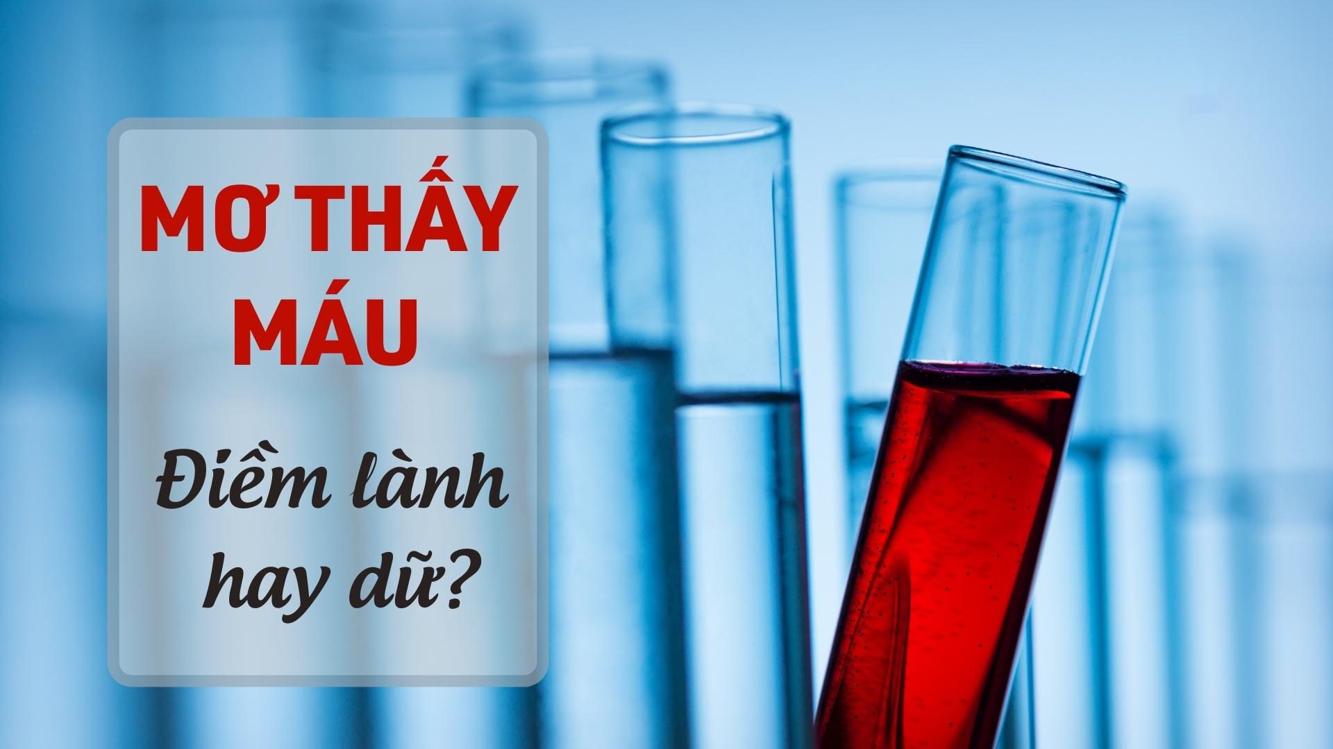 Mơ thấy máu lành hay dữ? Đánh con gì may mắn tại SV88?